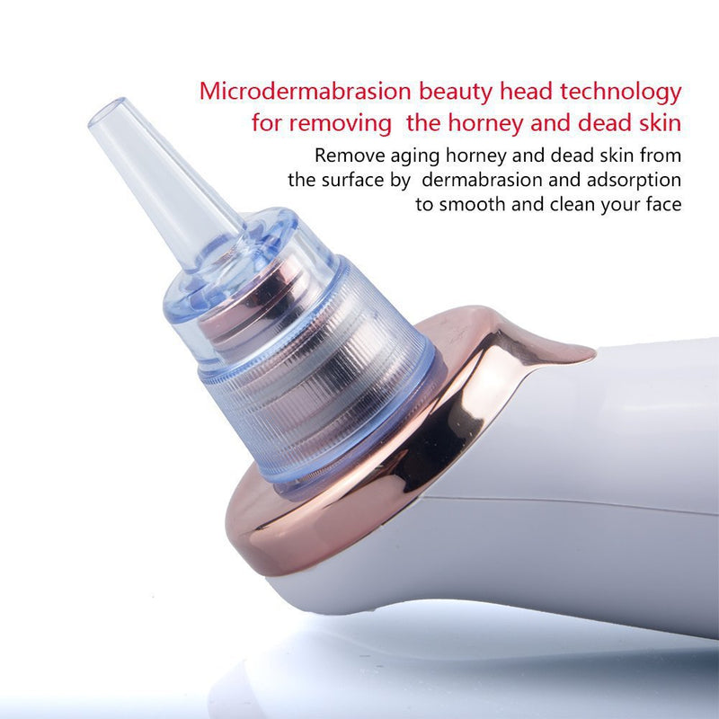 Blackhead Remover Skin Care Pore Vacuum - Passion Present 